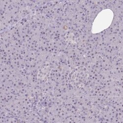 ARID3B Antibody, Novus Biologicals 0.1mL; Unlabeled:Antibodies, Polyclonal