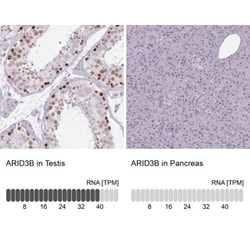 ARID3B Antibody, Novus Biologicals 0.1mL; Unlabeled:Antibodies, Polyclonal