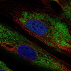 ARID5B Antibody, Novus Biologicals 0.1mL; Unlabeled:Antibodies, Polyclonal