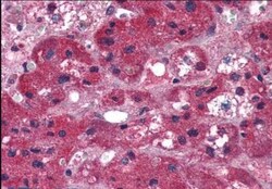 ARIH1 Antibody, Novus Biologicals 0.1mg; Unlabeled:Antibodies, Polyclonal