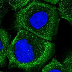 ARL13A Antibody, Novus Biologicals 0.1mL; Unlabeled:Antibodies, Polyclonal