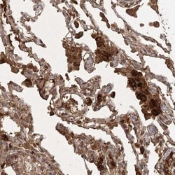 ARL13A Antibody, Novus Biologicals 0.1mL; Unlabeled:Antibodies, Polyclonal