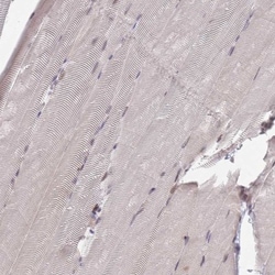 ARL13B Antibody, Novus Biologicals 0.1mL; Unlabeled:Antibodies, Polyclonal