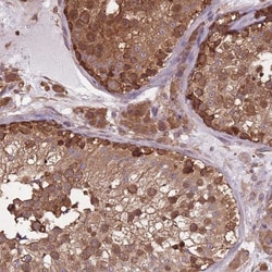 ARL13B Antibody, Novus Biologicals 0.1mL; Unlabeled:Antibodies, Polyclonal
