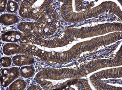 ARL14 Antibody, Novus Biologicals 0.1mg; Unlabeled:Antibodies, Polyclonal