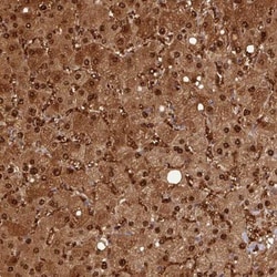 ARL17A Antibody, Novus Biologicals 25 &mu;L; Unlabeled:Antibodies, Polyclonal