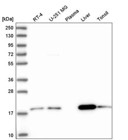 ARL17A Antibody, Novus Biologicals 25 &mu;L; Unlabeled:Antibodies, Polyclonal