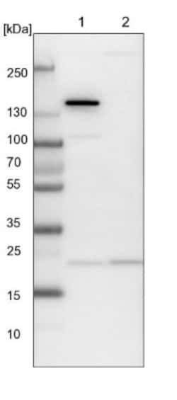 ARL3 Antibody, Novus Biologicals 0.1mL; Unlabeled:Antibodies, Polyclonal