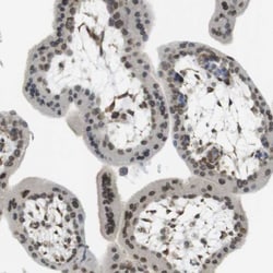 ARL6IP6 Antibody, Novus Biologicals 0.1mL; Unlabeled:Antibodies, Polyclonal