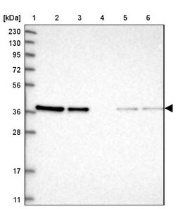 ARMC1 Antibody, Novus Biologicals 0.1mL; Unlabeled:Antibodies, Polyclonal