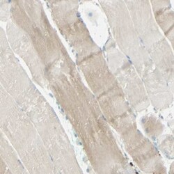 ARMC10 Antibody, Novus Biologicals:Antibodies:Primary Antibodies