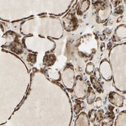 ARMC10 Antibody, Novus Biologicals:Antibodies:Primary Antibodies