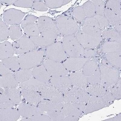 ARMC12 Rabbit anti-Human, Polyclonal, Novus Biologicals:Antibodies:Primary