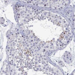 ARMC12 Rabbit anti-Human, Polyclonal, Novus Biologicals:Antibodies:Primary
