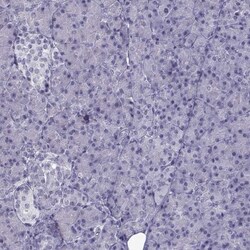 ARMC2 Antibody, Novus Biologicals 0.1 mL | Buy Online | Novus Biologicals | Fisher Scientific