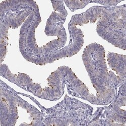ARMC3 Antibody, Novus Biologicals:Antibodies:Primary Antibodies