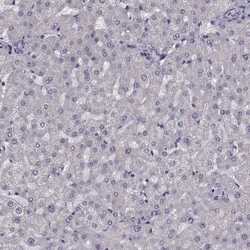 ARMC3 Antibody, Novus Biologicals:Antibodies:Primary Antibodies