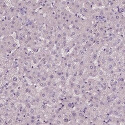 ARMC3 Antibody, Novus Biologicals 0.1 mL | Buy Online | Novus Biologicals | Fisher Scientific