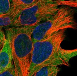 ARMC6 Antibody, Novus Biologicals 0.1mL; Unlabeled:Antibodies, Polyclonal