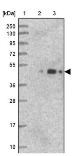 ARMC6 Antibody, Novus Biologicals 0.1mL; Unlabeled:Antibodies, Polyclonal