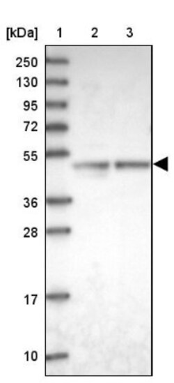 ARMC6 Antibody, Novus Biologicals 25 &mu;L, Unlabeled:Antibodies, Polyclonal