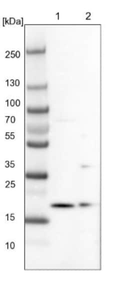 ARMC7 Antibody, Novus Biologicals:Antibodies:Primary Antibodies