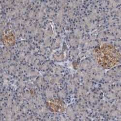 ARMCX2 Antibody, Novus Biologicals:Antibodies:Primary Antibodies