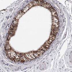 ARMCX2 Antibody, Novus Biologicals:Antibodies:Primary Antibodies