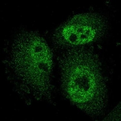 ARMCX3 Antibody, Novus Biologicals:Antibodies:Primary Antibodies