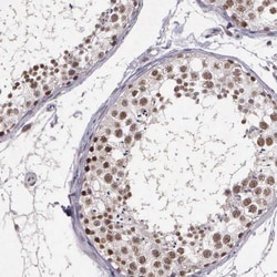 ARMCX5 Antibody, Novus Biologicals 25 &mu;L | Buy Online | Novus Biologicals | Fisher Scientific