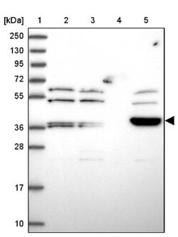 ARMCX6 Antibody, Novus Biologicals 25 &mu;L | Buy Online | Novus Biologicals | Fisher Scientific