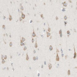 MANF Antibody, Novus Biologicals 25 &mu;L | Buy Online | Novus Biologicals | Fisher Scientific