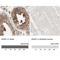 MANF Antibody, Novus Biologicals 25 &mu;L | Buy Online | Novus Biologicals | Fisher Scientific