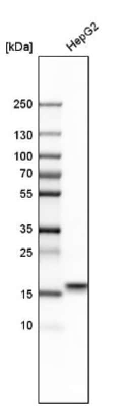 MANF Antibody, Novus Biologicals 25 &mu;L | Buy Online | Novus Biologicals | Fisher Scientific