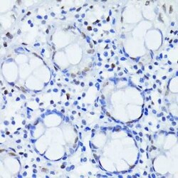 ARNT/HIF-1 beta Rabbit anti-Human, Clone: 3R0Y4, Novus Biologicals 20 &mu;g;