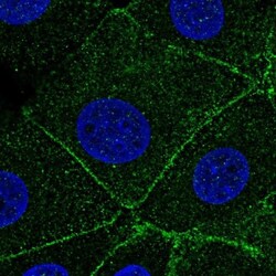 ARPC1A Antibody, Novus Biologicals 25 &mu;L; Unlabeled:Antibodies, Polyclonal