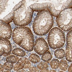 ARPC1A Antibody, Novus Biologicals 25 &mu;L; Unlabeled:Antibodies, Polyclonal