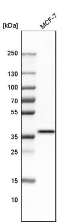 ARPC1A Antibody, Novus Biologicals 25 &mu;L; Unlabeled:Antibodies, Polyclonal