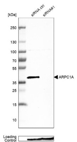 ARPC1A Antibody, Novus Biologicals 25 &mu;L; Unlabeled:Antibodies, Polyclonal