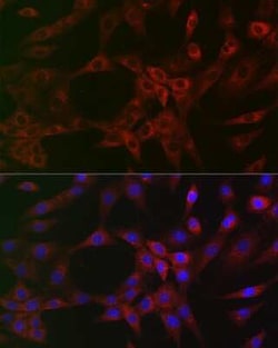 ARPC2 Rabbit anti-Human, Mouse, Rat, Clone: 4F2G6, Novus Biologicals 20