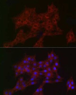 ARPC2 Rabbit anti-Human, Mouse, Rat, Clone: 4F2G6, Novus Biologicals 20