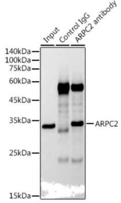 ARPC2 Rabbit anti-Human, Mouse, Rat, Clone: 4F2G6, Novus Biologicals 20