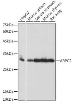 ARPC2 Rabbit anti-Human, Mouse, Rat, Clone: 4F2G6, Novus Biologicals 20