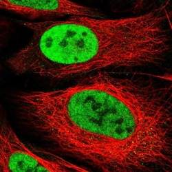 ARS2 Antibody, Novus Biologicals 0.1mL; Unlabeled:Antibodies, Polyclonal