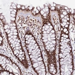ARS2 Antibody, Novus Biologicals 0.1mL; Unlabeled:Antibodies, Polyclonal