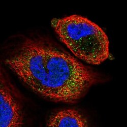 ARSK Antibody, Novus Biologicals 25 &mu;L; Unlabeled:Antibodies, Polyclonal