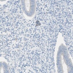 ART3 Antibody, Novus Biologicals 0.1mL; Unlabeled:Antibodies, Polyclonal