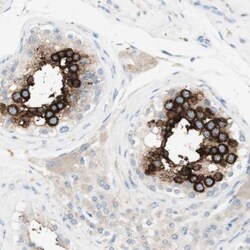 ART3 Antibody, Novus Biologicals 0.1mL; Unlabeled:Antibodies, Polyclonal