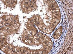 ART5 Antibody, Novus Biologicals 0.1mg; Unlabeled:Antibodies, Polyclonal