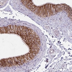 ARVCF Antibody, Novus Biologicals:Antibodies:Primary Antibodies